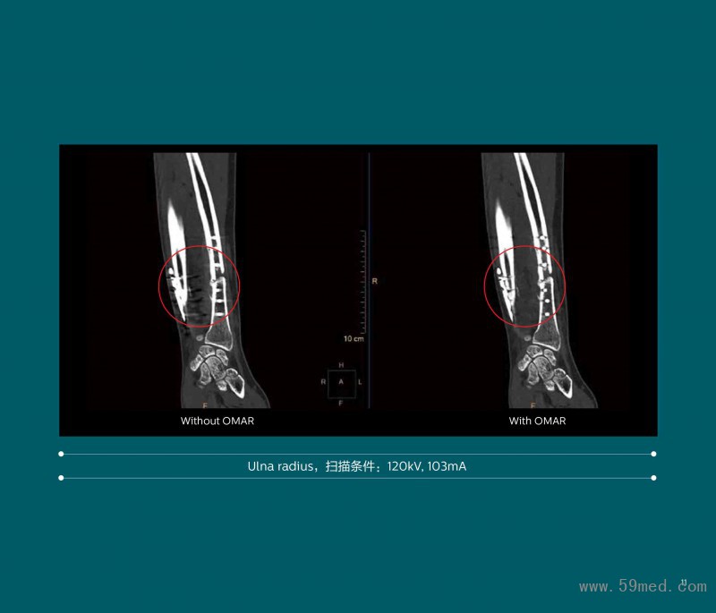 2020-CT-0018-V1---智惠尊享 晨光CT-飛利浦64層Incisive CT_196-11